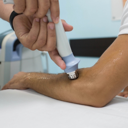 Shockwave-therapy-physiotherapy-image-Zenith-Physiotherapy-and-wellness-Airdrie-AB